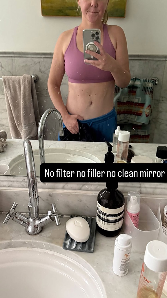 Amy Schumer weight loss