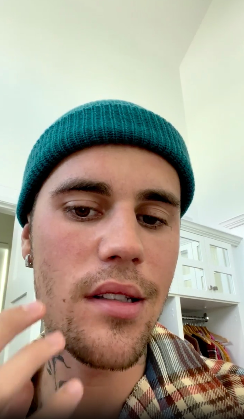 Justin Bieber, Ramsay Hunt syndrome