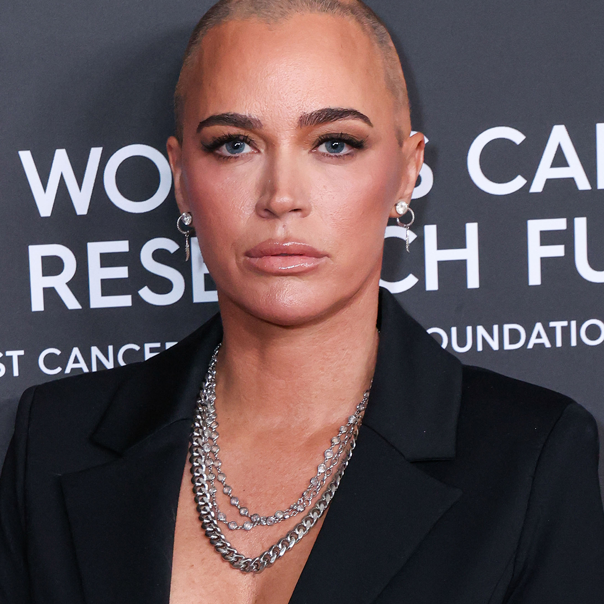 Teddi Mellencamp Shares Anxiety Over First Anniversary of Cancer Diagnosis