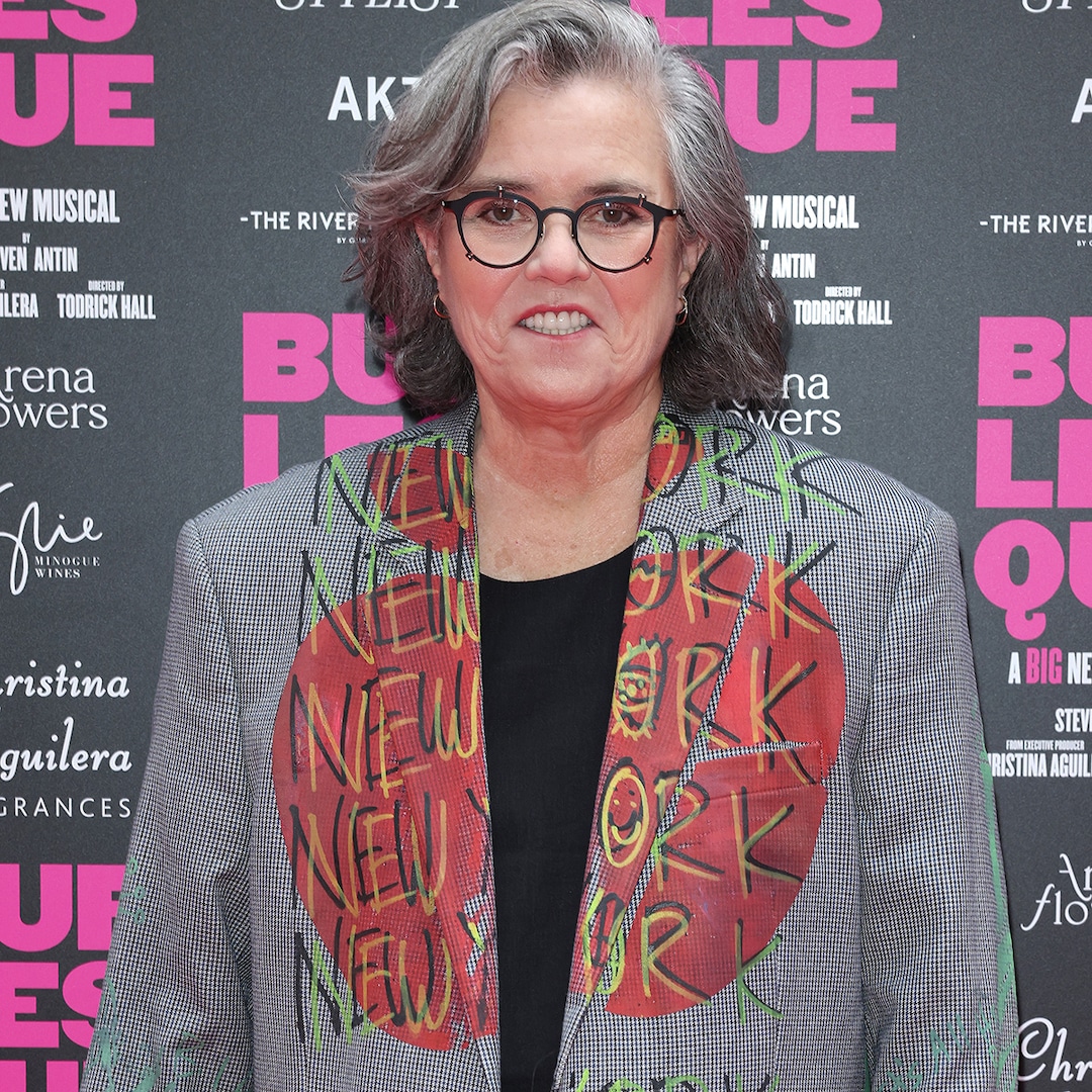 Rosie O’Donnell’s Facelift Results in Before-and-After Photos Rosie O’Donnell’s Facelift Results in Before-and-After Photos